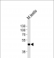 Mouse Mos Antibody (C-term)