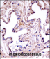 Mouse Akt1 Antibody (N-term)