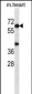 Mouse Akt1 Antibody (N-term)