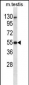 Mouse Dapk3 Antibody (Center)