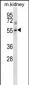 Mouse Tgfbr1 Antibody (Center)