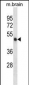 Mouse Camk2a Antibody (C-term)