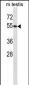 WWOX Antibody (C-term)