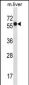 SLC45A3 Antibody (Center)