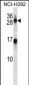 KLK14 Antibody (N-term)