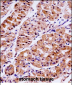 KLK15 Antibody (Center)