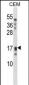 KLK15 Antibody (Center)