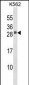 HBEGF Antibody (Center)