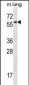 Mouse Fyn Antibody (C-term)