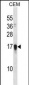 FAM163A Antibody (Center)