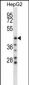 HYAL1 Antibody (C-term)