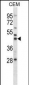 Mouse Map2k2 Antibody (N-term)