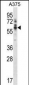 Mouse Ptk6 Antibody (N-term)