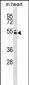 Mouse Ptk6 Antibody (N-term)