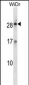 KLK12 Antibody (Center)