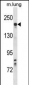 Mouse Kdr Antibody (C-term)