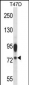 AMFR Antibody (Center)