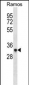 Mouse Aurkb Antibody (N-term)