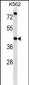 P2RX2 Antibody (N-term)