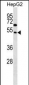 FAM83A Antibody (Center D283)