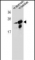 RAB25 Antibody (Center)