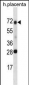 SPINT1 Antibody (Center)