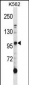 Mouse Axl Antibody (N-term)