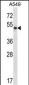 PNLIP Antibody (C-term)