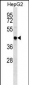 TRAF4 Antibody (C-term)