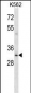 Mouse Hoxb8 Antibody (C-term)