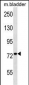 Mouse Cabc1 Antibody (Center)