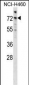 Mouse Araf Antibody (Center)