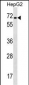 CACNB1 Antibody (C-term)