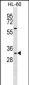 Mouse Hoxb13 Antibody (Center)