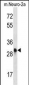 Mouse Cdk1 Antibody (C-term)