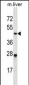 Mouse Cdk2 Antibody (C-term)