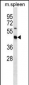 Mouse Stradb Antibody (C-term)