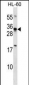 HOXB8 Antibody (C-term)