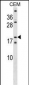 SSX4 Antibody (Center)