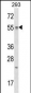 TTC23 Antibody (Center)