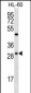 FMR1NB Antibody (N-term)