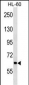 ANKHD1 Antibody (N-term)