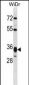 HMGCL Antibody (Center)