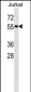 Mouse Mapk14 Antibody (N-term)