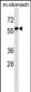 RUNDC1 Antibody (C-term)