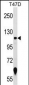 ZNF217 Antibody (N-term)