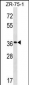 FUT7 Antibody (N-term)