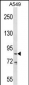 DDX53 Antibody (C-term)