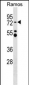 MTA3 Antibody (C-term)