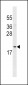 ADI1 Antibody (Center)